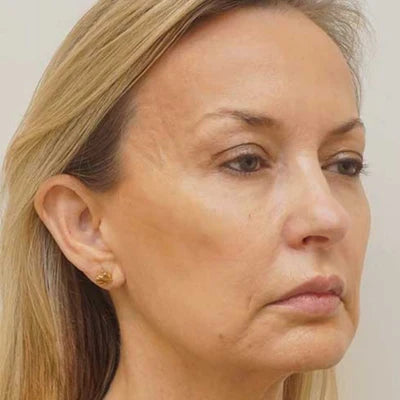 Antes